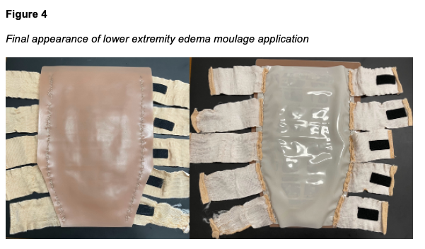 lower extremity - figure 4