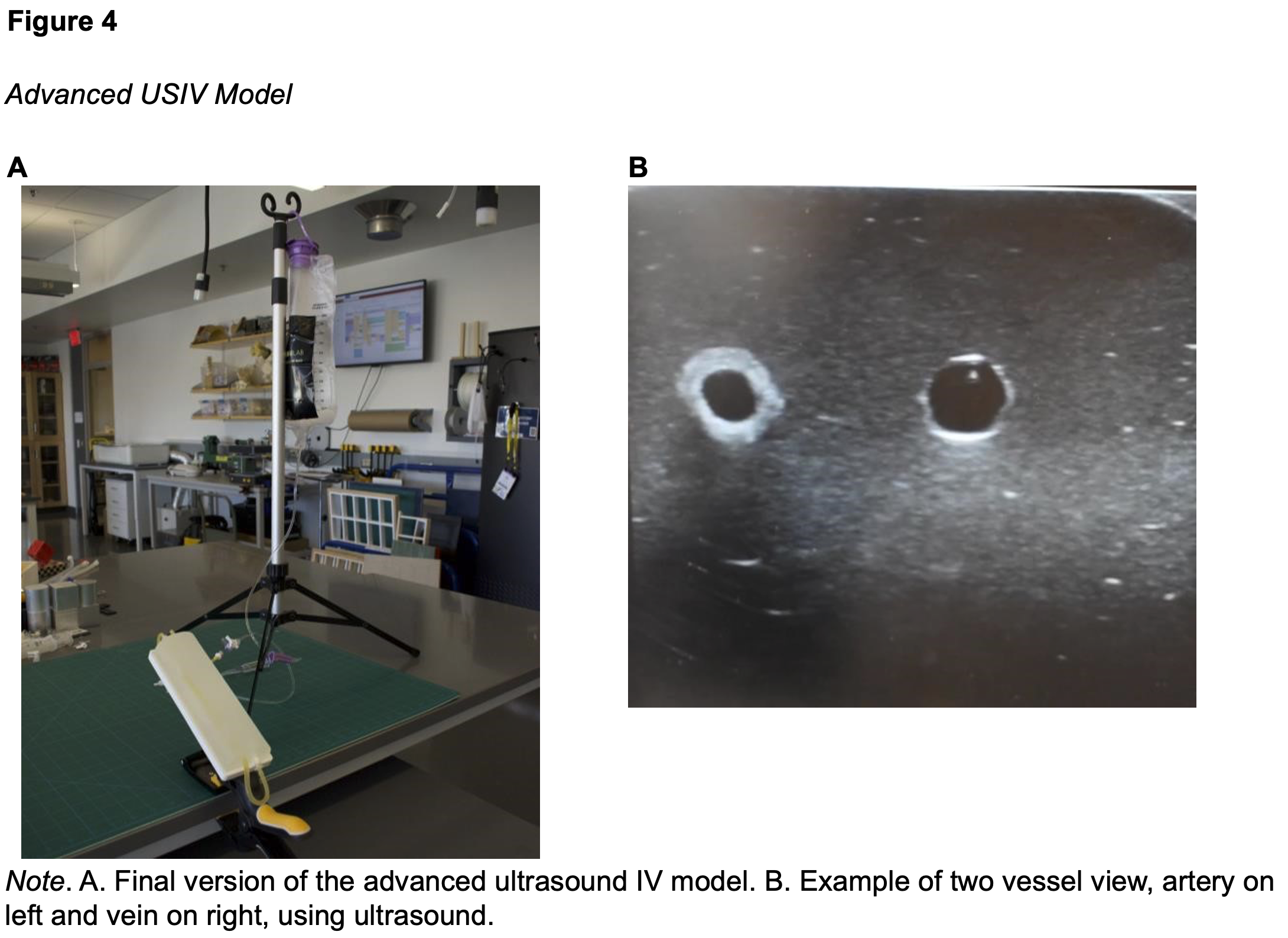 Advanced USIV Model